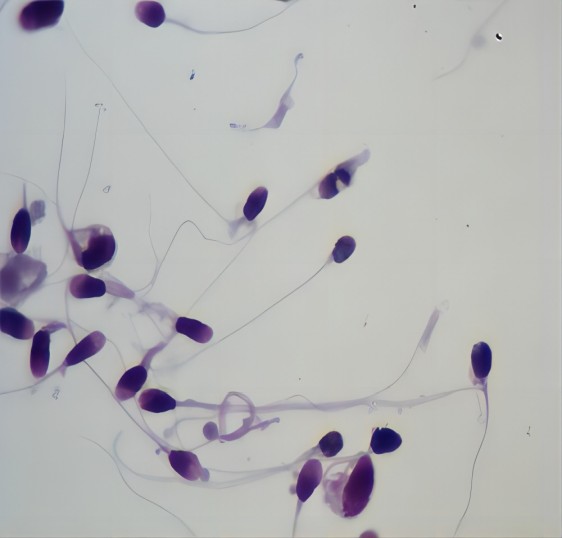 Computer Assisted Semen Sperm Morphology Analysis
