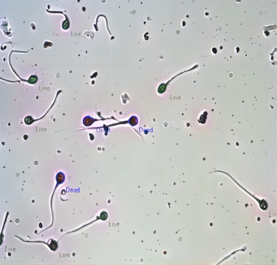 CASA Sperm Analysis Sperm Vitality Analysis System